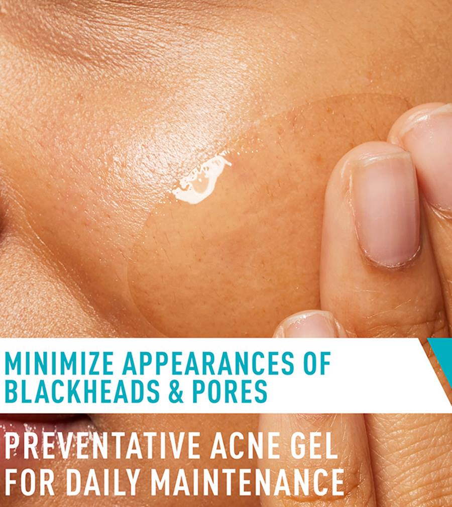 Acne Control Gel - Image 4